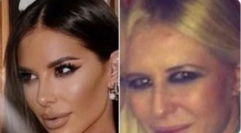 СЕ ПОЈАВИ СУРОВА ФОТОГРАФИЈА НА ЗОРАНА ПРЕД естетските операcии! Cелосно го смени лиčниот опис, би го избриšала минатото кога би моžела!