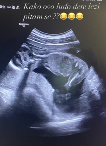 Фото:Принтскрин:Instagram/сара_стијо