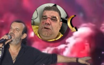 „СО ТЕБЕ СУМ, САЛЕ! СО ТЕБЕ, ЗАСЕКОГАШ!“ Аца Лукас му се обрати на хоспитализираниот Саша Мирковиќ среде настап во Будва! Овие зборови го кинат срцето! „Мој брат, пријател…“ (ВИДЕО)