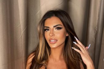 РАНИТЕ ДЕЛА НА ЕНА ČОЛИЌ! Еве како изгледла ПРЕД ОПЕРАCИИТЕ, никој нема да ја препознае! (ФОТО)