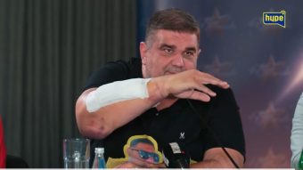 „ОВА Е РАКАТА СО 40 КОНЦИ! Вградени се титаниумски плочи!“ Саша Мирковиќ не знае какви ќе бидат ПОСЛЕДИЦИТЕ ОД ПОВРЕДИТЕ