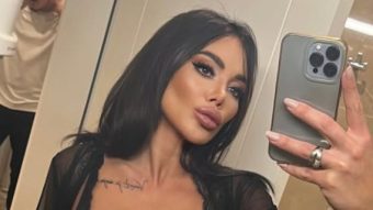 ЦЕЛА НАЦИЈА ШОКИРАНА ОД НОВИОТ ЗАФАТ НА ТАМАРА ЃУРИЌ! Си инјектирала и во колената, вакво нешто досега никој не видел! (ФОТО)