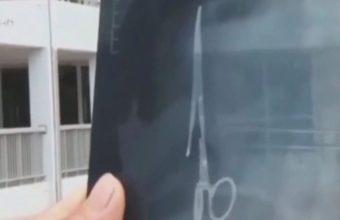 Трпел страшни болки во стомакот, отишол да направи рентген: Лекарите не можеле да се соземат