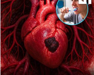 Пропуштањето вечерно миење заби може да го зголеми ризикот од срцеви заболувања