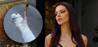 ТАРА СИМОВ ЗАВРШИ ВО ГИПС! По излегувањето од болница ги откри сите детали за повредата! (ФОТО)