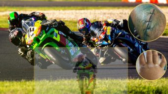 ПОВРЕДЕН, НО НЕПОБЕДЛИВ: ПЕТАР МИЈАЛКОВ СО ХЕРОЈСКИ НАСТАП ВО СЛОВАЧКА! (ВИДЕО)