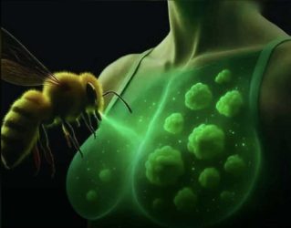 ОТРОВОТ ОД ПЧЕЛИ УСПЕШНО ГИ УНИШТУВА СИТЕ АГРЕСИВНИ КЛЕТКИ НА РАК НА ДОЈКА ЗА ПОМАЛКУ ОД 60 МИНУТИ – ОТКРИВА ЛАБОРАТОРИСКО ИСПИТУВАЊЕ!