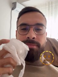 Стефан Лазаров со оток и мраз на лицето – ќе снимал видео?!